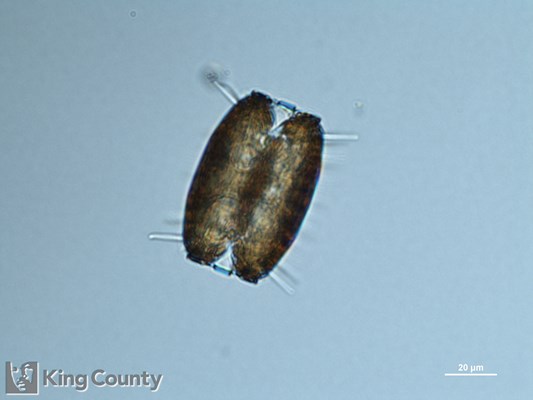 Photo of Thalassiosira punctigera